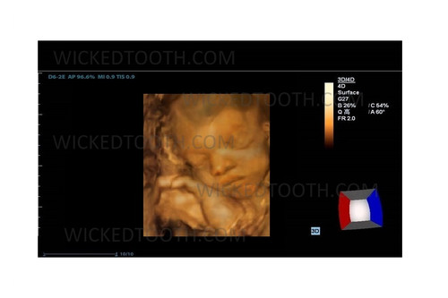 Fake ultrasound prank | Fakeultrasound.com