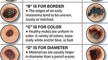 Skin Cancer Awareness