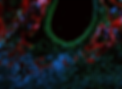 Endothelial Gelfoam