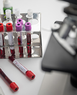 Labs Pic