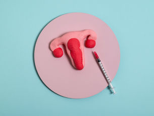 Intrauterine Insemination