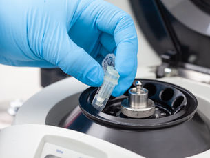 Cryopreservation