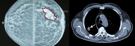 MIAAI (Medical Image Analysis & Artificial Intelligence) at Danube Private University in Austria