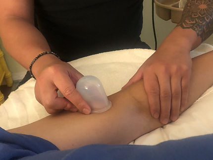 Cupping.jpg