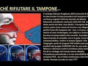 Il TAMPONE provoca danni al cervello, ma per l’Humanitas è colpa del Coronavirus