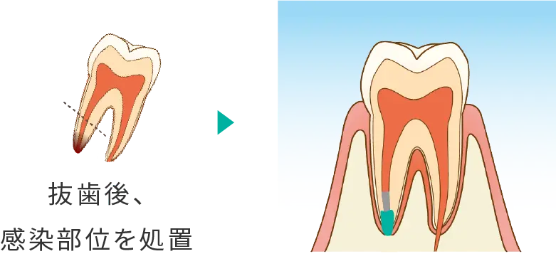 surgery_section03_2.webp