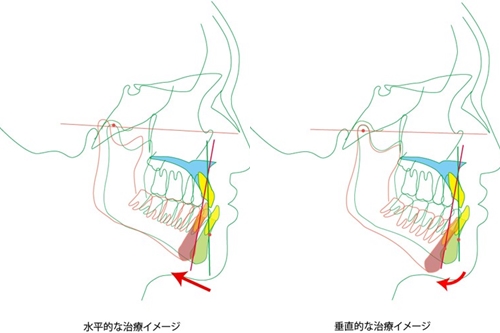 治療イメージ