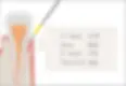 perio_sec03_1_2_2x.webp