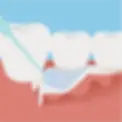 periodontal_sec03_1.webp