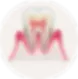 perio3_2x.webp