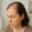 alopecia frontal fem.jpg