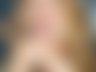 What Invisalign Can Do!