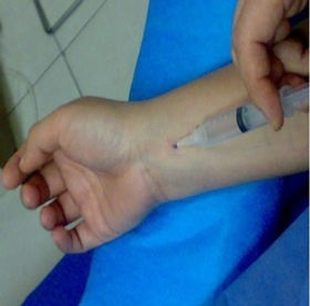 Ozonoterapia