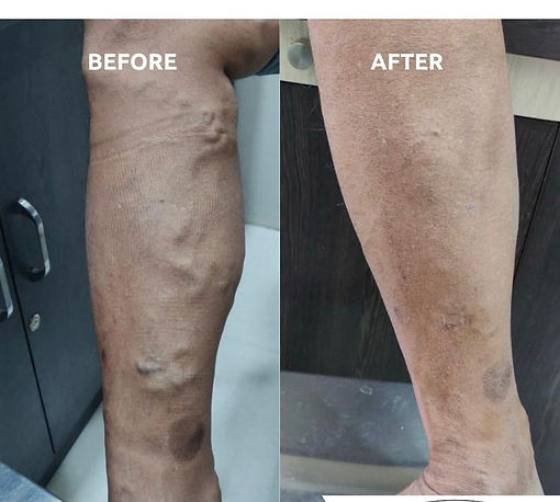 Dr. Ashank-DVT.jpeg