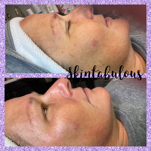 Derma-Plane Glow
