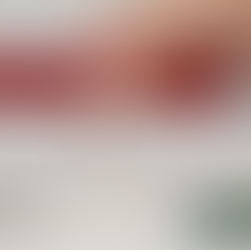 Finger Prick Zinzino Balance Blood Test