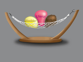 Pelvic Organ Prolapse (POP)