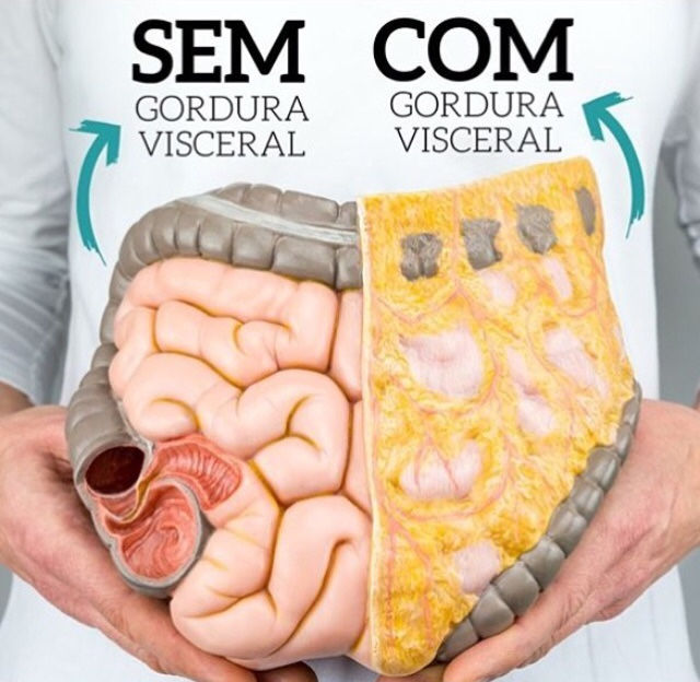 O excesso de gordura visceral aumenta