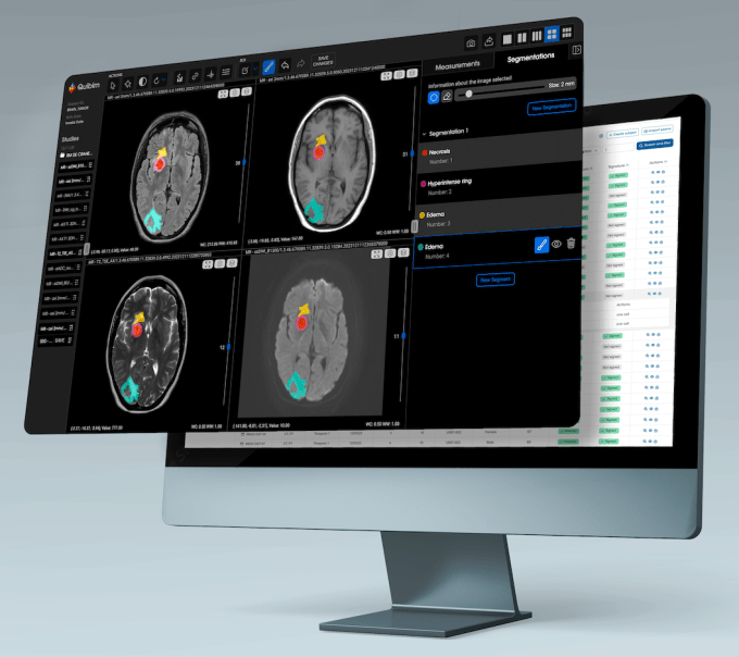 Quibim: QP-Insights