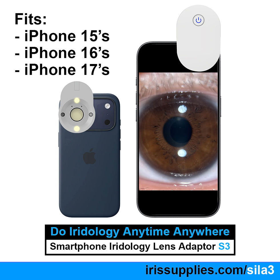 Smartphone Iridology Lens Adaptor S3