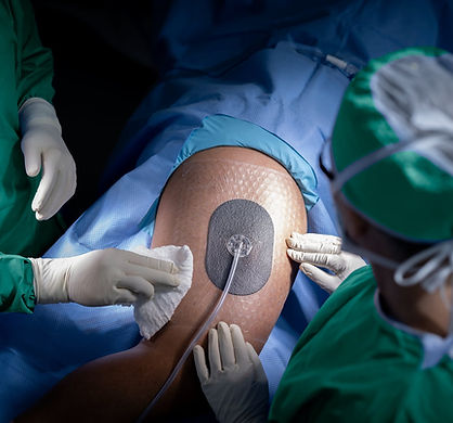 V.A.C.® - Hastanede kalış süresi ve komplikasyon riskini azaltma