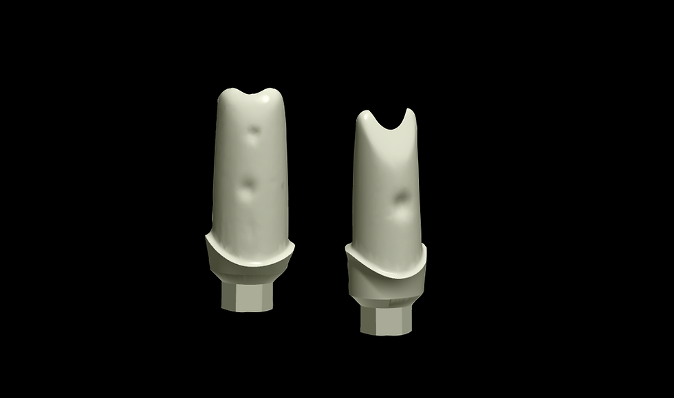 Custom Abutment
