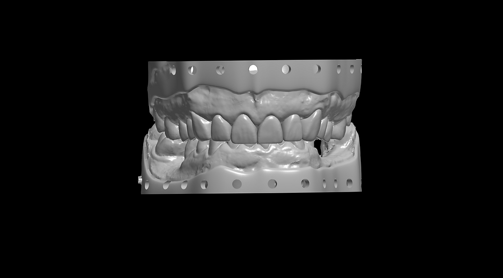 Model Design