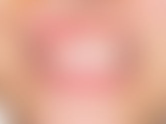 Diş eti kanaması normal midir?