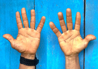 “Exterminio total” fue el nombre de la operación con la que el Estado ecuatoriano irrumpió en la comunidad de San Martín, en la frontera norte: incendió y bombardeó infraestructura civil destinada a la ganadería, secuestró, torturó y abandonó a cuatro comuneros en las afueras de Lago Agrio.