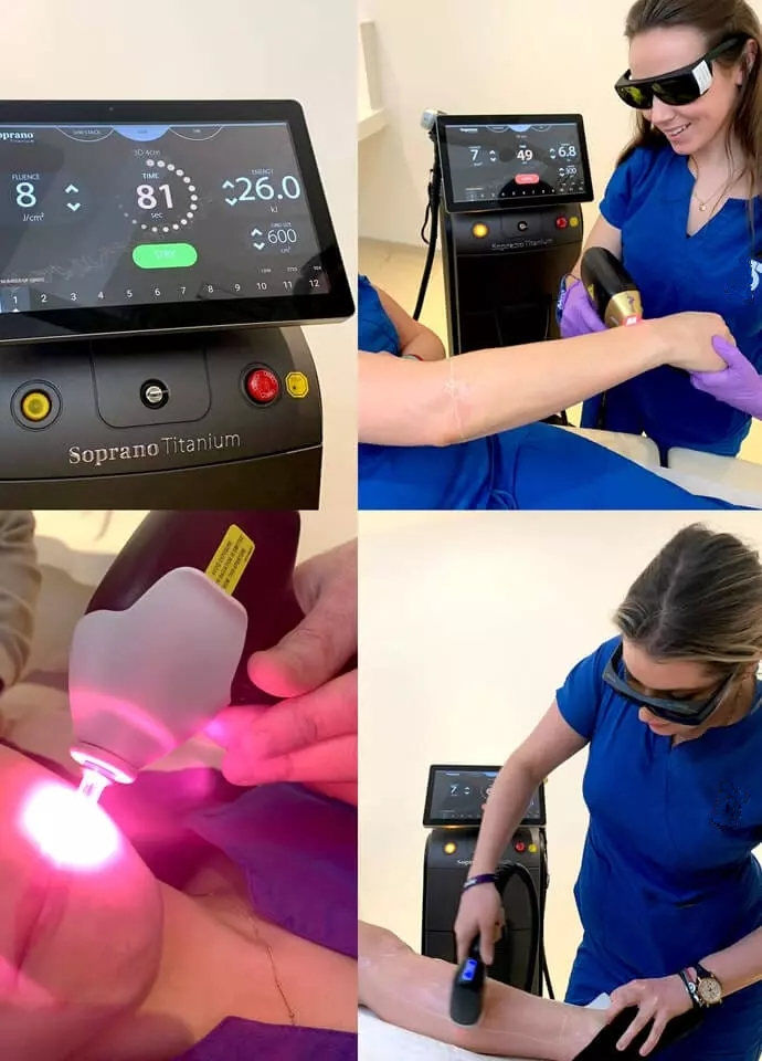 Thumbnail: Soprano Titanium Hair Removal Machine