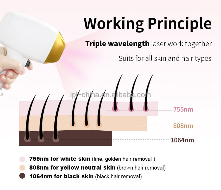 Thumbnail: good price 1064 755 808nm  3 wavelength  diode laser ice hair removal epilator 