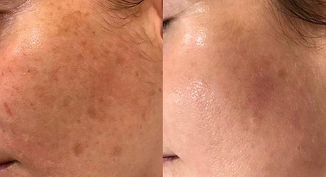 9dc1b3b4-932c-4500-ab95-dc2f6c0742ee.JPG
