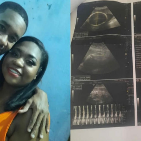 Surpresa aos nove meses: casal descobre gravidez dias antes do parto