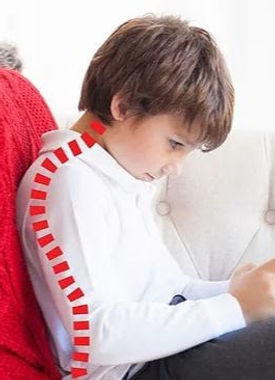 Bad posture in Children, Hong Kong. osteopathy