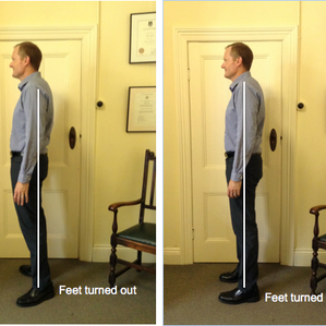 Do your feet turn out? - Its time for some "direction correction".