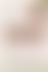 IPL vs Laser vs Microneedling