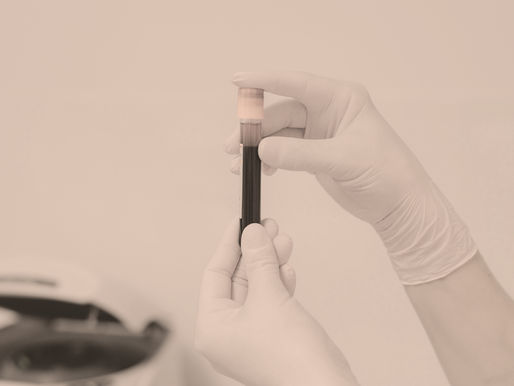 Understanding Chemical Tests in Ohio DUI Cases