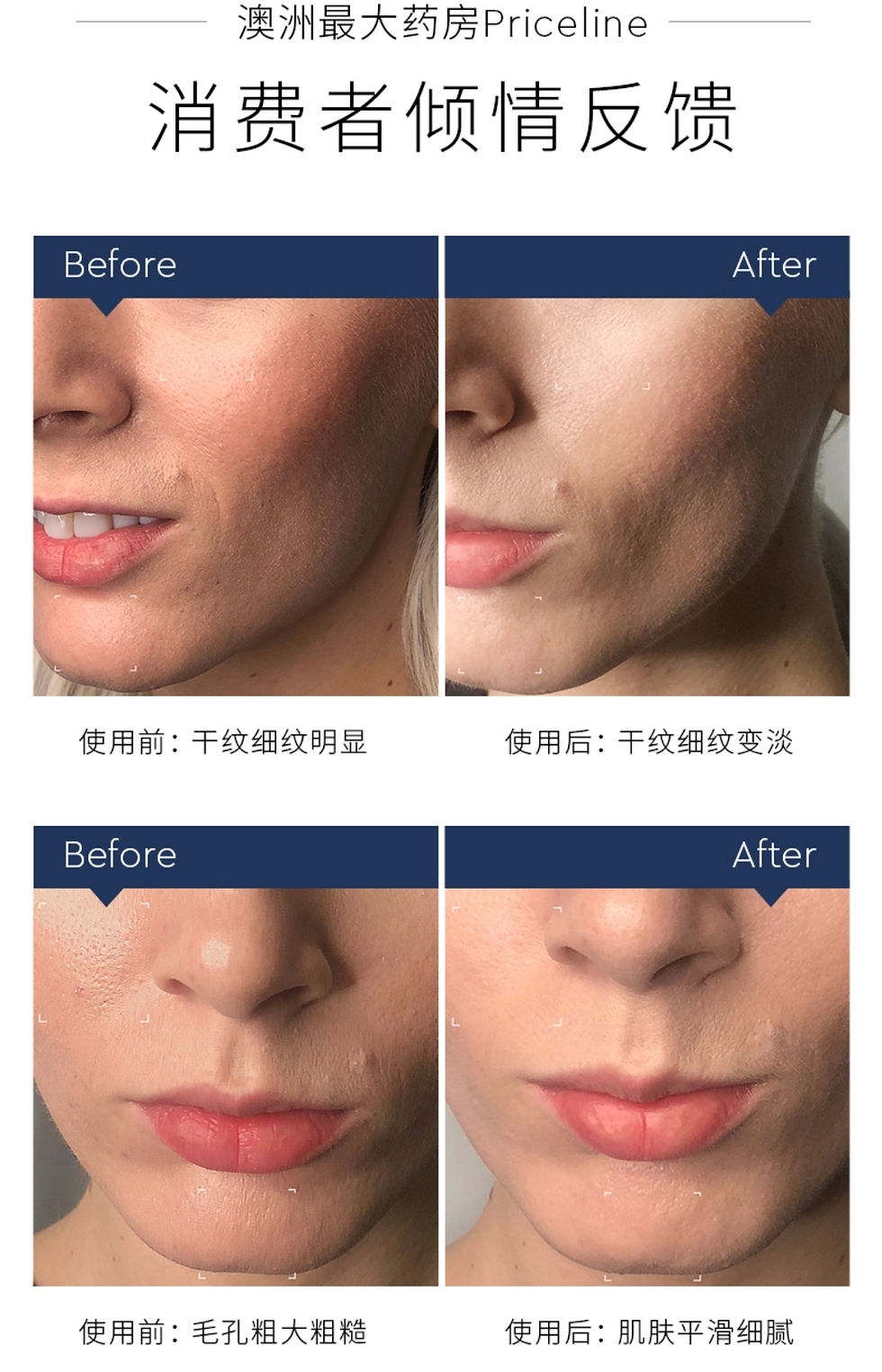 Thumbnail: Cemoy Inception Sleeping Cream & Mask 80g 小陀螺塗抹式睡眠面膜 80g