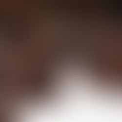 Dark Chocolate Bites