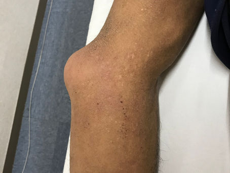 マイオセラピー勉強会11月！