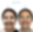 Pasien 8 - Before After Invisalign.png