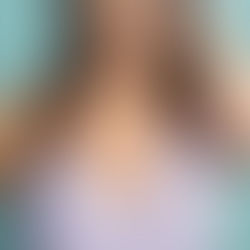 woman with uneven breasts feeling self-conscious