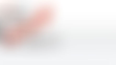 Falha crítica de injeção sql em sites com o sistema Magento