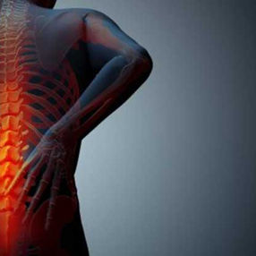 SUS incorpora medicamento para tratamento de mieloma múltiplo