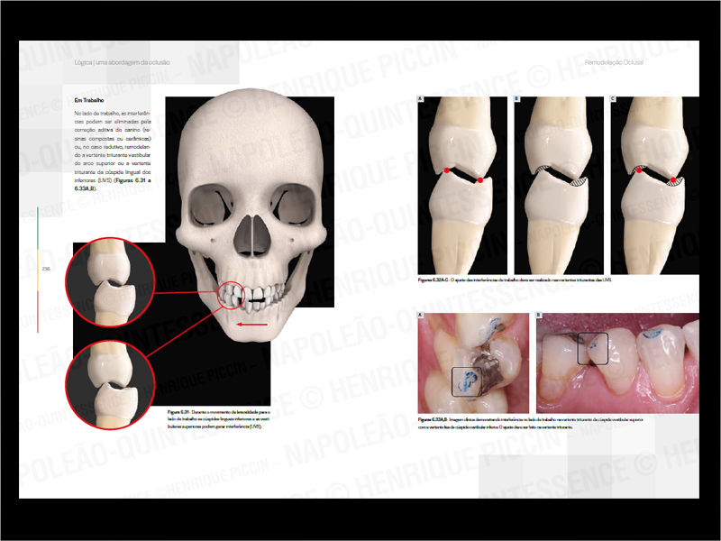 Thumbnail: Logical Book - a Clinical Approach to Occlusion (Volume I)
