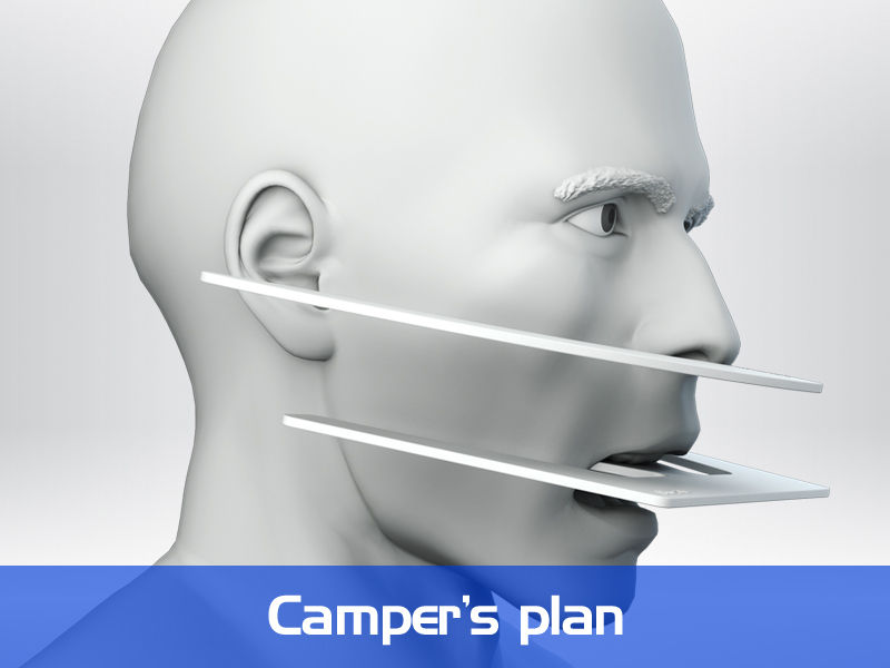 Thumbnail: Articulator Accessories - Fox Ruler