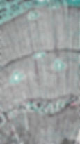 A close-up view of a tissue sample under a microscope.