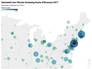 Visualizing Liver Screening and Diagnosis