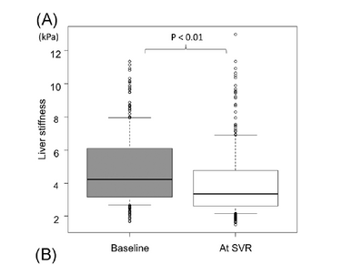 Changes in MRE in HCV patients who achieve SVR