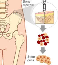 stem cell EXTRACTION